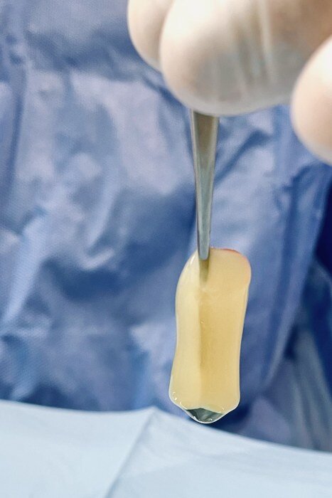 Plasma Dental EstetiQ Plasma Dental EstetiQ