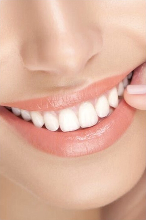 Estética Dental EstetiQ Estética Dental EstetiQ