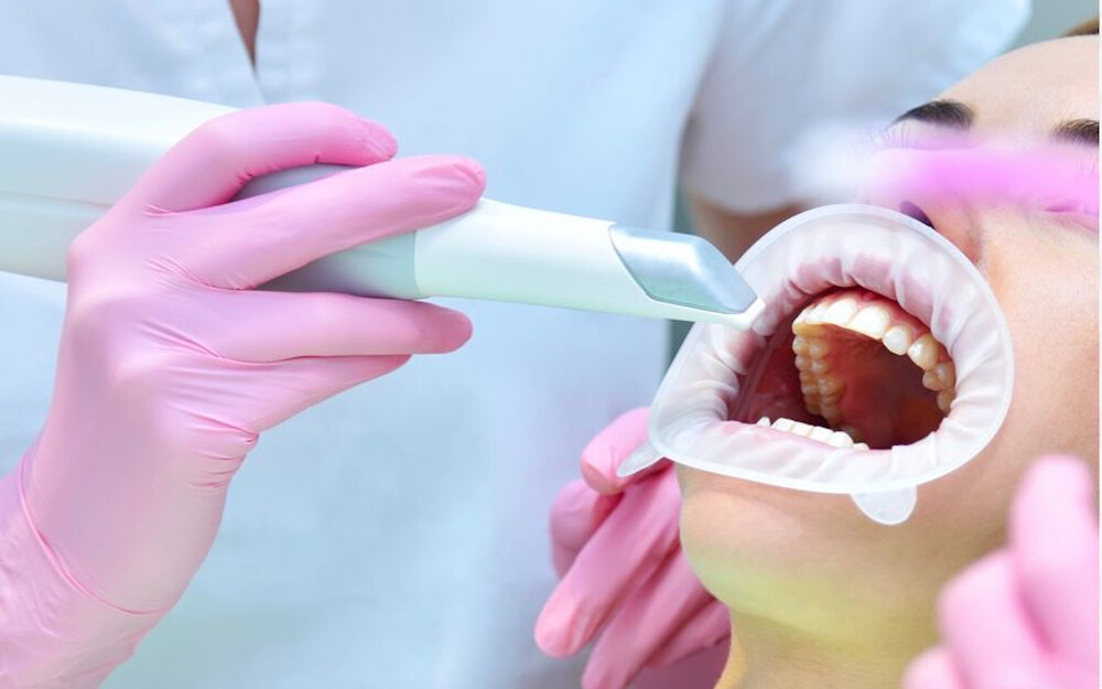 Es un dispositivo que escanea el interior de nuestra boca y la transforma en formato digital 3D, para luego, poder trabajar sobre esta.