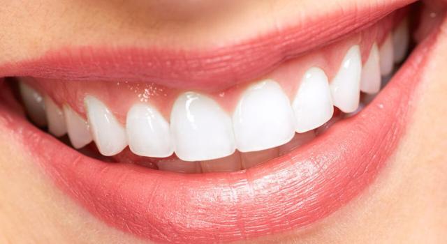 ESTÉTICA DENTAL ESTÉTICA DENTAL